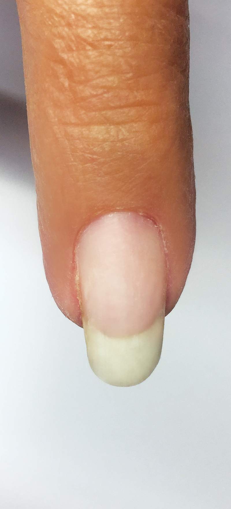 nail gombusz egy alkalmazáshoz)
